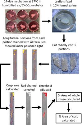 Organ Culture Model of Aortic Valve Calcification